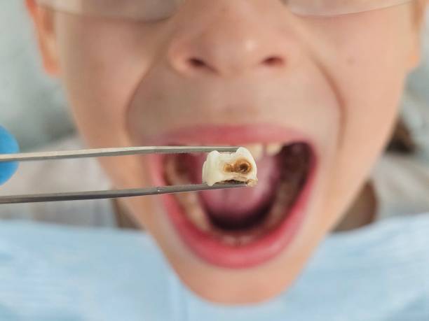 Best 24-Hour Emergency Dentist  in Ladoga, IN